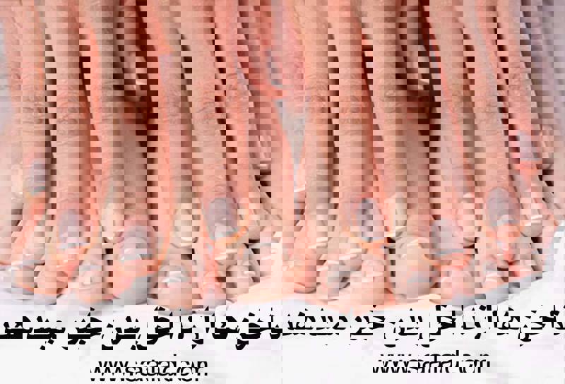 ناخن‌ها می‌توانند نشان‌دهنده وضعیت سلامت عمومی شما باشند