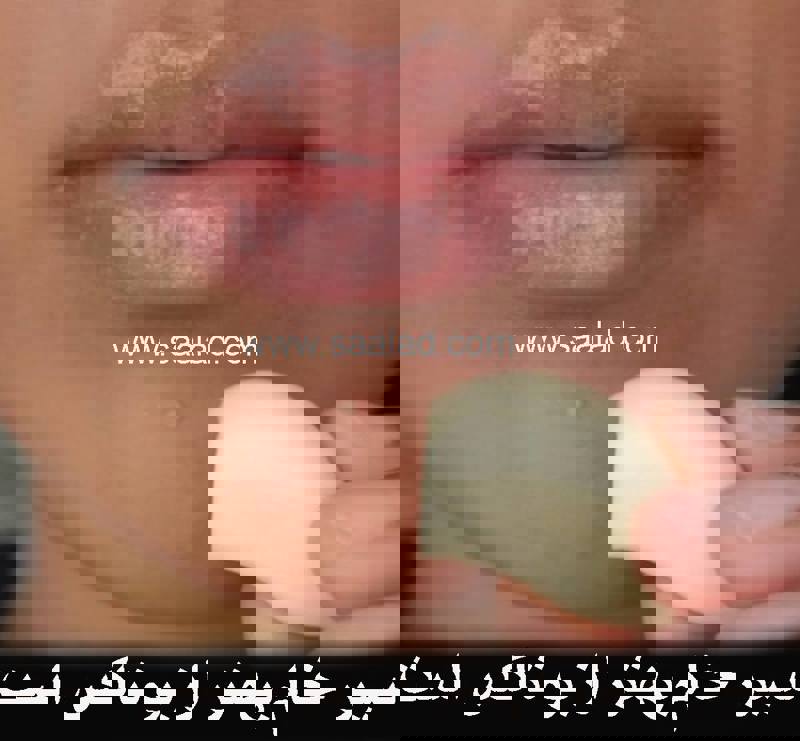 سیر درمانی و بوتاکس