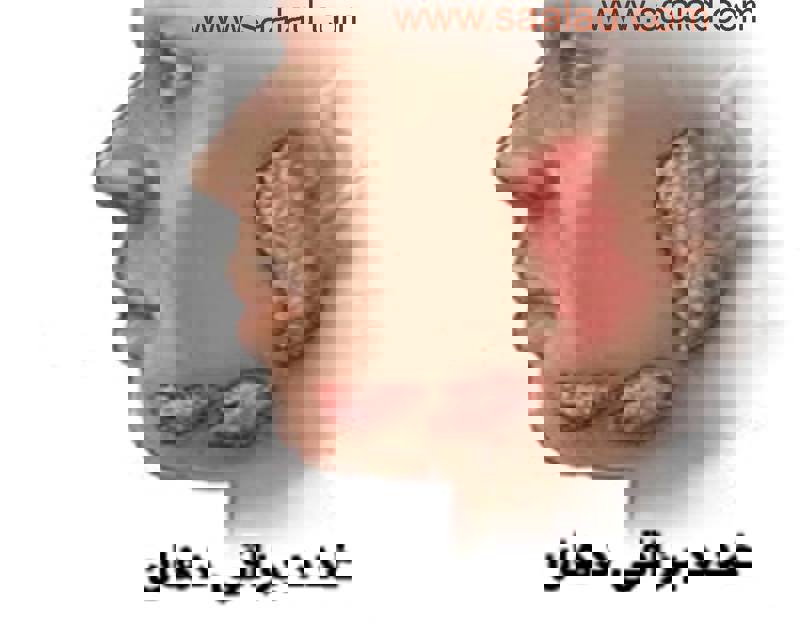 غدد بزاقی (به انگلیسی: Salivary gland)